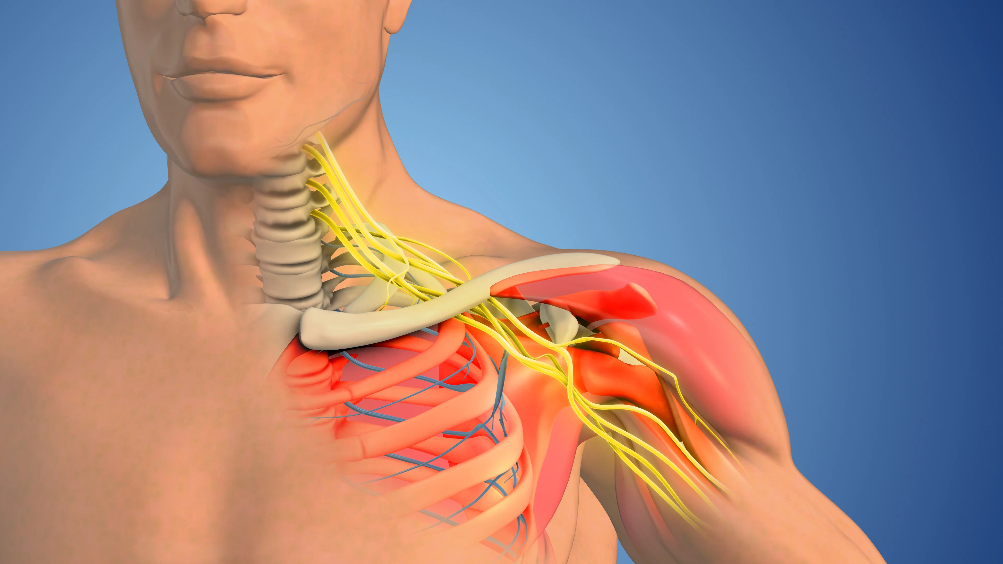 Medical illustration of thoracic outlet syndrome brachial plexus anatomy - chiropractor San Antonio TX