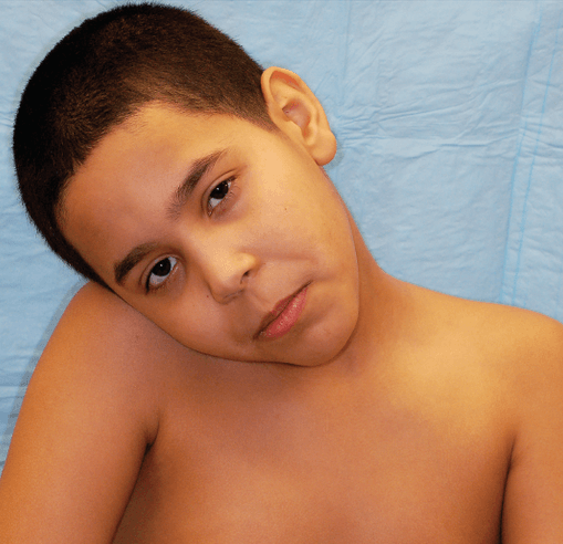 Woman with neck pain and restricted rotation from torticollis - chiropractor San Antonio TX