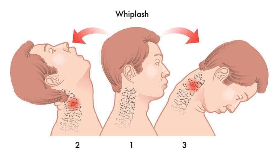 Whiplash Chiropractor in San Antonio, TX | Dr. Dan Foss